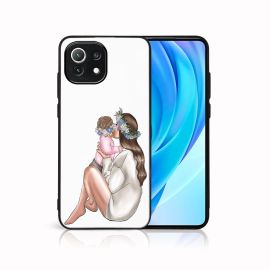 MY ART Cover protettiva Xiaomi Mi 11 Lite / 11 Lite 5G / 11 Lite NE 5G GIRL (111)